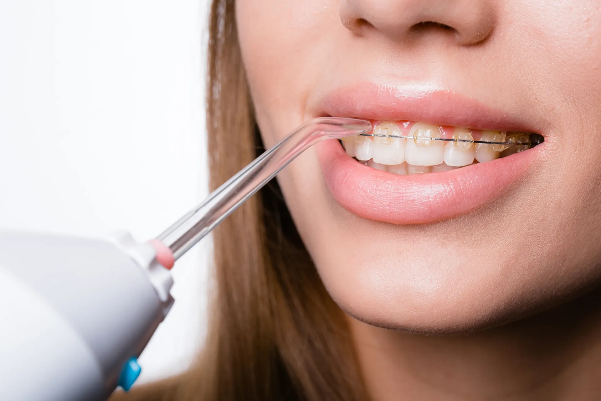 Cosmetic dentistry